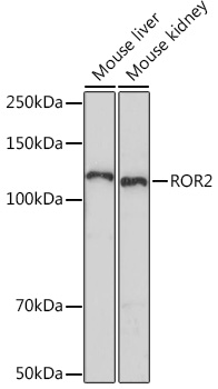 Western blot analysis of various lysates using ROR2 Rabbit mAb (TA426399) at 1:1000 dilution.<br/>Secondary antibody: HRP-conjugated Goat anti-Rabbit IgG (H+L) at 1:10000 dilution.<br/>Lysates/proteins: 25μg per lane.<br/>Blocking buffer: 3% nonfat dry milk in TBST.<br/>Detection: ECL Enhanced Kit .<br/>Exposure time: 90s.