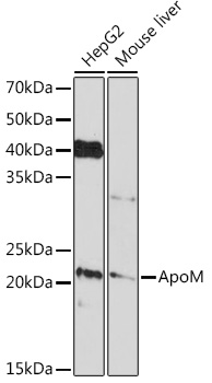 Confocal imaging of Hep G2 cells using ApoM Rabbit mAb (TA426406, dilution 1:100) followed by a further incubation with Cy3 Goat Anti-Rabbit IgG (H+L) (AS007, dilution 1:500) (Red). The cells were counterstained with α-Tubulin Mouse mAb (AC012, dilution 1:400) followed by incubation with ABflo® 488-conjugated Goat Anti-Mouse IgG (H+L) Ab (AS076, dilution 1:500) (Green). DAPI was used for nuclear staining (Blue). Objective: 100x.
