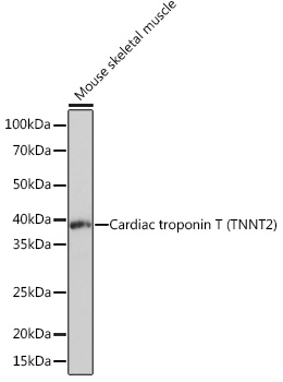 Immunohistochemistry analysis of paraffin-embedded Mouse heart using Cardiac troponin T (TNNT2) Rabbit mAb (TA426431) at dilution of 1:100 (40x lens). Microwave antigen retrieval performed with 0.01M PBS Buffer (pH 7.2) prior to IHC staining.