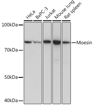 Western blot analysis of various lysates using Moesin Rabbit mAb (TA426441) at 1:1000 dilution.<br/>Secondary antibody: HRP-conjugated Goat anti-Rabbit IgG (H+L) at 1:10000 dilution.<br/>Lysates/proteins: 25μg per lane.<br/>Blocking buffer: 3% nonfat dry milk in TBST.<br/>Detection: ECL Basic Kit .<br/>Exposure time: 1s.