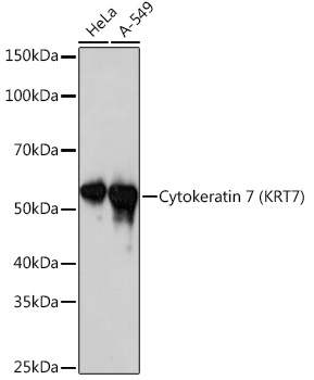 Western blot analysis of various lysates using Cytokeratin 7 (KRT7) (KRT7)  Rabbit mAb (TA426446) at 1:1000 dilution.<br/>Secondary antibody: HRP-conjugated Goat anti-Rabbit IgG (H+L) at 1:10000 dilution.<br/>Lysates/proteins: 25μg per lane.<br/>Blocking buffer: 3% nonfat dry milk in TBST.<br/>Detection: ECL Basic Kit .<br/>Exposure time: 10s.