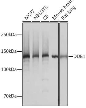 Western blot analysis of various lysates using DDB1 Rabbit mAb (TA426455) at 1:1000 dilution incubated overnight at 4℃.<br/>Secondary antibody: HRP-conjugated Goat anti-Rabbit IgG (H+L) at 1:10000 dilution.<br/>Lysates/proteins: 25μg per lane.<br/>Blocking buffer: 3% nonfat dry milk in TBST.<br/>Detection: ECL Basic Kit .<br/>Exposure time: 1s.