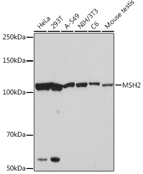 Western blot analysis of various lysates using MSH2 Rabbit mAb (TA426459) at 1:1000 dilution.<br/>Secondary antibody: HRP-conjugated Goat anti-Rabbit IgG (H+L) at 1:10000 dilution.<br/>Lysates/proteins: 25μg per lane.<br/>Blocking buffer: 3% nonfat dry milk in TBST.<br/>Detection: ECL Basic Kit .<br/>Exposure time: 90s.
