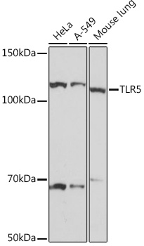 Western blot analysis of various lysates using TLR5 Rabbit mAb (TA426466) at 1:1000 dilution.<br/>Secondary antibody: HRP-conjugated Goat anti-Rabbit IgG (H+L) at 1:10000 dilution.<br/>Lysates/proteins: 25μg per lane.<br/>Blocking buffer: 3% nonfat dry milk in TBST.<br/>Detection: ECL Basic Kit .<br/>Exposure time: 1s.