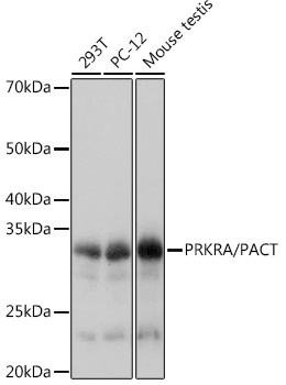 Western blot analysis of various lysates using PRKRA/PACTRabbit mAb (TA426469) at 1:1000 dilution.<br/>Secondary antibody: HRP-conjugated Goat anti-Rabbit IgG (H+L) at 1:10000 dilution.<br/>Lysates/proteins: 25μg per lane.<br/>Blocking buffer: 3% nonfat dry milk in TBST.<br/>Detection: ECL Basic Kit .<br/>Exposure time: 1s.