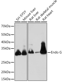 Western blot analysis of various lysates using Endo G Rabbit mAb (TA426474) at 1:1000 dilution.<br/>Secondary antibody: HRP-conjugated Goat anti-Rabbit IgG (H+L) at 1:10000 dilution.<br/>Lysates/proteins: 25μg per lane.<br/>Blocking buffer: 3% nonfat dry milk in TBST.<br/>Detection: ECL Basic Kit .<br/>Exposure time: 90s.