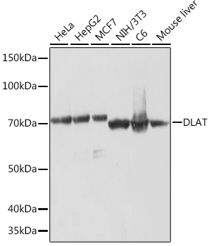 Western blot analysis of various lysates using DLAT Rabbit mAb (TA426478) at 1:1000 dilution.<br/>Secondary antibody: HRP-conjugated Goat anti-Rabbit IgG (H+L) at 1:10000 dilution.<br/>Lysates/proteins: 25μg per lane.<br/>Blocking buffer: 3% nonfat dry milk in TBST.<br/>Detection: ECL Basic Kit .<br/>Exposure time: 1min.