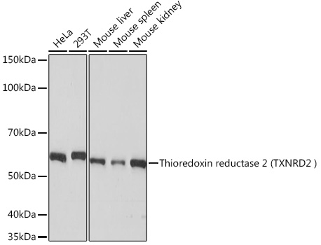 Western blot analysis of various lysates using Thioredoxin reductase 2 (Thioredoxin reductase 2 (TXNRD2 ) ) Rabbit mAb (TA426486) at 1:1000 dilution.<br/>Secondary antibody: HRP-conjugated Goat anti-Rabbit IgG (H+L) at 1:10000 dilution.<br/>Lysates/proteins: 25μg per lane.<br/>Blocking buffer: 3% nonfat dry milk in TBST.<br/>Detection: ECL Basic Kit .<br/>Exposure time: 10s.