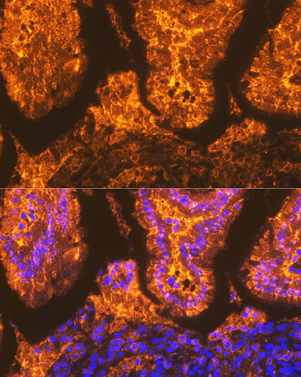 Confocal imaging of paraffin-embedded mouse small intestine using FABPI Rabbit mAb (TA426489,dilution 1:200) followed by a further incubation with Cy3 Goat Anti-Rabbit IgG (H+L) (AS007,dilution 1:500)(Red).DAPI was used for nuclear staining (Blue). Objective: 40x.Perform high pressure antigen retrieval with 0.01M citrate buffer (pH 6.0) prior to IF staining.