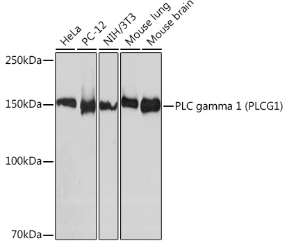 Western blot analysis of various lysates using PLC gamma 1 (PLC gamma 1 (PLCG1)) Rabbit mAb (TA426490) at 1:1000 dilution.<br/>Secondary antibody: HRP-conjugated Goat anti-Rabbit IgG (H+L) at 1:10000 dilution.<br/>Lysates/proteins: 25μg per lane.<br/>Blocking buffer: 3% nonfat dry milk in TBST.<br/>Detection: ECL Basic Kit .<br/>Exposure time: 30s.