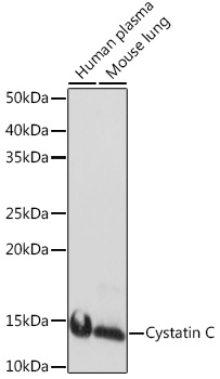 Western blot analysis of various lysates using Cystatin C Rabbit mAb (TA426495) at 1:1000 dilution.<br/>Secondary antibody: HRP-conjugated Goat anti-Rabbit IgG (H+L) at 1:10000 dilution.<br/>Lysates/proteins: 25μg per lane.<br/>Blocking buffer: 3% nonfat dry milk in TBST.<br/>Detection: ECL Basic Kit .<br/>Exposure time: 1s.