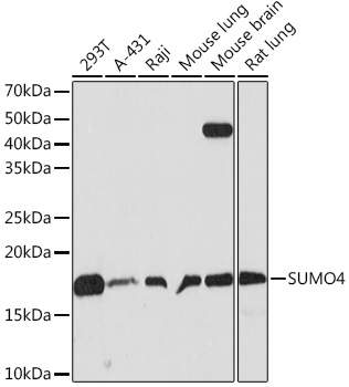 Western blot analysis of various lysates using SUMO4 Rabbit mAb (TA426508) at 1:500 dilution.<br/>Secondary antibody: HRP-conjugated Goat anti-Rabbit IgG (H+L) at 1:10000 dilution.<br/>Lysates/proteins: 25μg per lane.<br/>Blocking buffer: 3% nonfat dry milk in TBST.<br/>Detection: ECL Basic Kit .<br/>Exposure time: 30s.