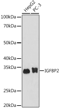 Western blot analysis of various lysates using IGFBP2 Rabbit mAb (TA426509) at 1:1000 dilution.<br/>Secondary antibody: HRP-conjugated Goat anti-Rabbit IgG (H+L) at 1:10000 dilution.<br/>Lysates/proteins: 25μg per lane.<br/>Blocking buffer: 3% nonfat dry milk in TBST.<br/>Detection: ECL Basic Kit .<br/>Exposure time: 180s.