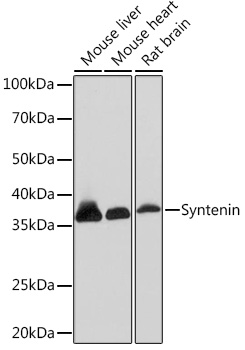 Western blot analysis of various lysates using Syntenin Rabbit mAb (TA426529) at 1:1000 dilution.<br/>Secondary antibody: HRP-conjugated Goat anti-Rabbit IgG (H+L) at 1:10000 dilution.<br/>Lysates/proteins: 25μg per lane.<br/>Blocking buffer: 3% nonfat dry milk in TBST.<br/>Detection: ECL Basic Kit .<br/>Exposure time: 3min.