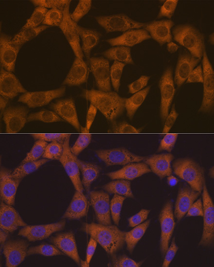 Confocal imaging of HeLa cells using CAD Rabbit mAb (TA426543, dilution 1:100) followed by a further incubation with Cy3 Goat Anti-Rabbit IgG (H+L) (AS007, dilution 1:500) (Red). The cells were counterstained with α-Tubulin Mouse mAb (AC012, dilution 1:400) followed by incubation with ABflo® 488-conjugated Goat Anti-Mouse IgG (H+L) Ab (AS076, dilution 1:500) (Green). DAPI was used for nuclear staining (Blue). Objective: 100x.