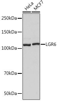 Western blot analysis of various lysates using LGR6 Rabbit mAb (TA426550) at 1:1000 dilution.<br/>Secondary antibody: HRP-conjugated Goat anti-Rabbit IgG (H+L) at 1:10000 dilution.<br/>Lysates/proteins: 25μg per lane.<br/>Blocking buffer: 3% nonfat dry milk in TBST.<br/>Detection: ECL Basic Kit .<br/>Exposure time: 3s.