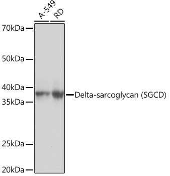 Western blot analysis of various lysates using Delta-sarcoglycan (SGCD) Rabbit mAb (TA426570) at 1:1000 dilution.<br/>Secondary antibody: HRP-conjugated Goat anti-Rabbit IgG (H+L) at 1:10000 dilution.<br/>Lysates/proteins: 25μg per lane.<br/>Blocking buffer: 3% nonfat dry milk in TBST.<br/>Detection: ECL Basic Kit .<br/>Exposure time: 3s.