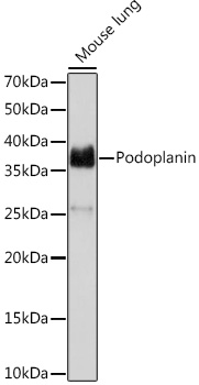 Western blot analysis of lysates from Mouse lung, using Podoplanin Rabbit mAb (TA426585) at 1:1000 dilution.<br/>Secondary antibody: HRP-conjugated Goat anti-Rabbit IgG (H+L) at 1:10000 dilution.<br/>Lysates/proteins: 25μg per lane.<br/>Blocking buffer: 3% nonfat dry milk in TBST.<br/>Detection: ECL Basic Kit .<br/>Exposure time: 30s.