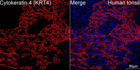 Confocal imaging of human tonsil tissue using Cytokeratin 4 (KRT4) Rabbit mAb (TA426784,dilution 1:100)(Red). DAPI was used for nuclear staining (blue). Objective: 40x.Perform high pressure antigen retrieval with 10 mM citrate buffer (pH 6.0) before commencing with IF staining protocol.