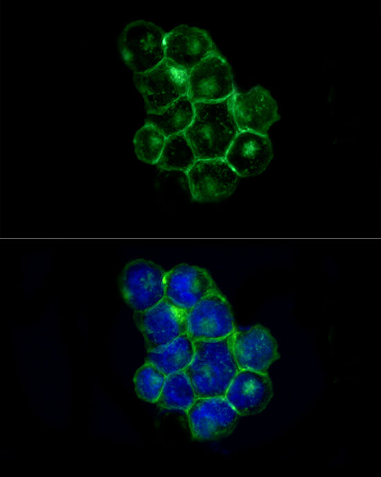 IFITM1 Rabbit Monoclonal Antibody [Clone ID: 9A8O7]