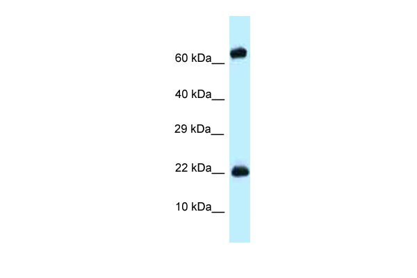 WB Suggested Anti-Zfp580 Antibody<br/>Titration: 1.0 ug/ml<br/>Positive Control: Mouse Spleen