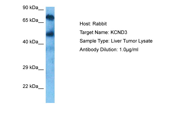 Host: Rabbit<br/>Target Name: KCND3<br/>Sample Tissue: Liver Tumor lysates<br/>Antibody Dilution: 1ug/ml
