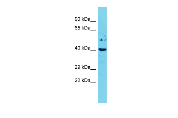 Host: Rabbit<br/>Target Name: Esr2<br/>Sample Type: Mouse Spleen lysates<br/>Antibody Dilution: 1.0ug/ml
