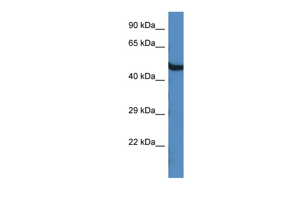 WB Suggested Anti-Oasl1 Antibody<br/>Titration: 1.0 ug/ml<br/>Positive Control: Mouse Brain