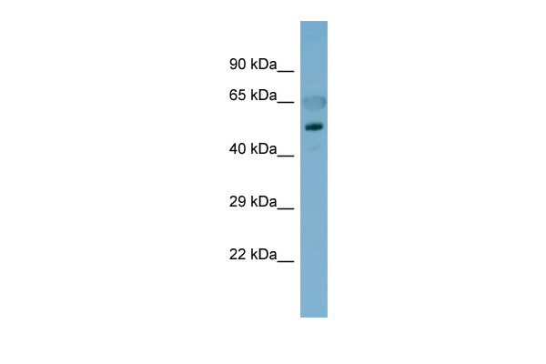 Host: Rabbit<br/>Target Name: CDH8<br/>Sample Type: Fetal Stomach lysates<br/>Antibody Dilution: 1.0ug/ml