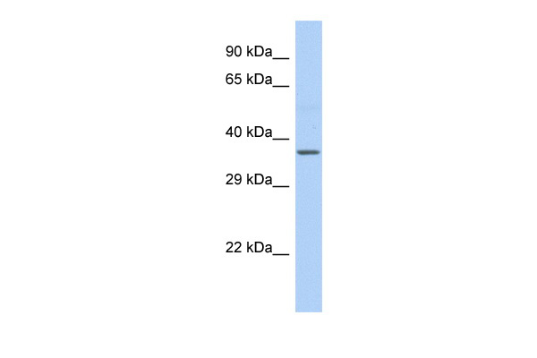 Host: Rabbit<br/>Target Name: cytb<br/>Sample Type: Fetal Liver lysates<br/>Antibody Dilution: 1.0ug/ml