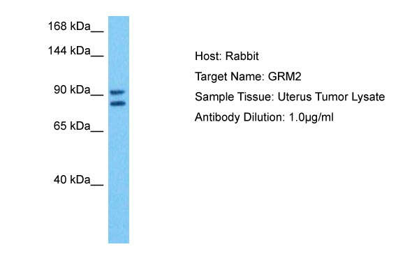 WB Suggested Anti-GRM2 antibody Titration: 1 ug/mL<br/>Sample Type: Human Uterus Tumor
