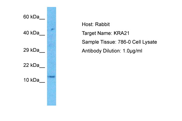 Host: Rabbit<br/>Target Name: KRA21<br/>Sample Type: 786-0 Whole Cell lysates<br/>Antibody Dilution: 1.0ug/ml