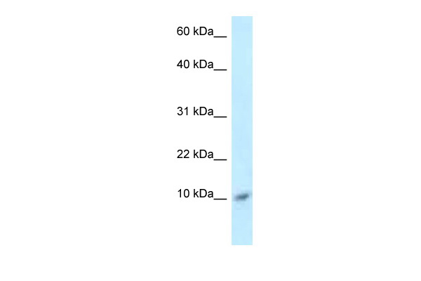 WB Suggested Anti-S100A8 Antibody<br/>Titration: 1.0 ug/ml<br/>Positive Control: ACHN Whole Cell