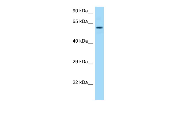 WB Suggested Anti-TCP1 Antibody<br/>Titration: 1.0 ug/ml<br/>Positive Control: Placenta