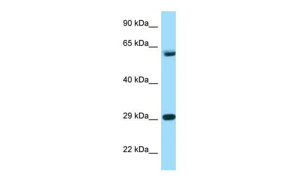 WB Suggested Anti-TCP1 Antibody<br/>Titration: 1.0 ug/ml<br/>Positive Control: Hela Whole CellTCP1 is strongly supported by BioGPS gene expression data to be expressed in Human HeLa cells