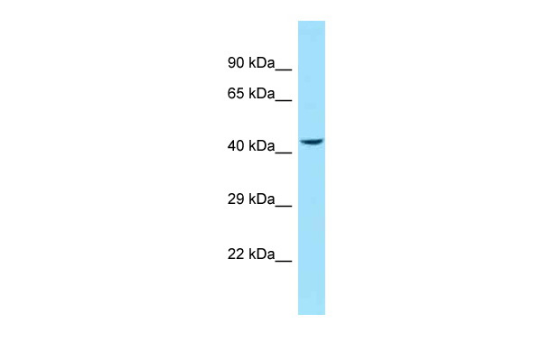 WB Suggested Anti-P2RY11 Antibody<br/>Titration: 1.0 ug/ml<br/>Positive Control: Hela Whole Cell