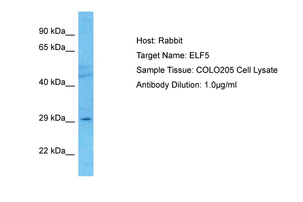 Host: Rabbit<br/>Target Name: ELF5<br/>Sample Type: COLO205 Whole Cell lysates<br/>Antibody Dilution: 1.0ug/ml