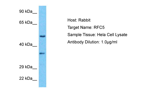 Host: Rabbit<br/>Target Name: RFC5<br/>Sample Type: Hela Whole Cell lysates<br/>Antibody Dilution: 1ug/ml