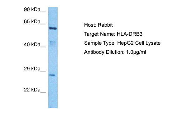 Host: Rabbit<br/>Target Name: HLA-DRB3<br/>Sample Tissue: HepG2 Whole Cell lysates<br/>Antibody Dilution: 1ug/ml