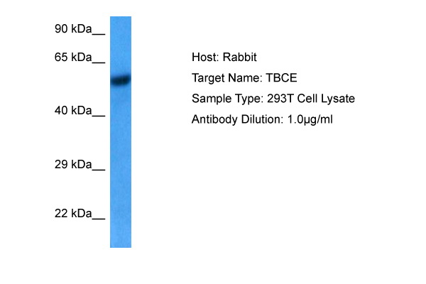 Host: Rabbit<br/>Target Name: TBCE<br/>Sample Tissue: Human 293T Whole Cell lysates<br/>Antibody Dilution: 1ug/ml