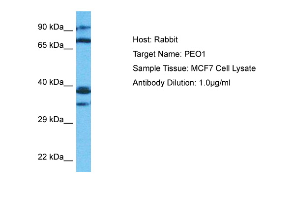 Host: Rabbit<br/>Target Name: PEO1<br/>Sample Type: MCF7 Whole Cell lysates<br/>Antibody Dilution: 1.0ug/ml