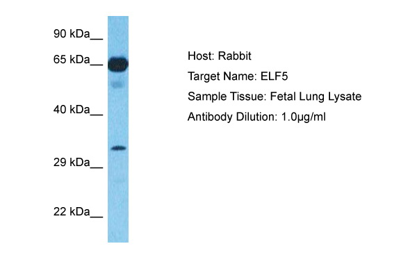 Host: Rabbit<br/>Target Name: ELF5<br/>Sample Type: Fetal Lung lysates<br/>Antibody Dilution: 1.0ug/ml