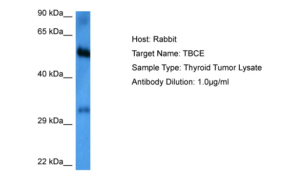 Host: Rabbit<br/>Target Name: TBCE<br/>Sample Tissue: Thyroid Tumor lysates<br/>Antibody Dilution: 1ug/ml