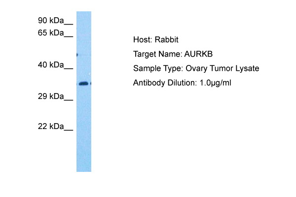 Host: Rabbit<br/>Target Name: AURKB<br/>Sample Tissue: Human Ovary Tumor<br/>Antibody Dilution: 1.0ug/ml