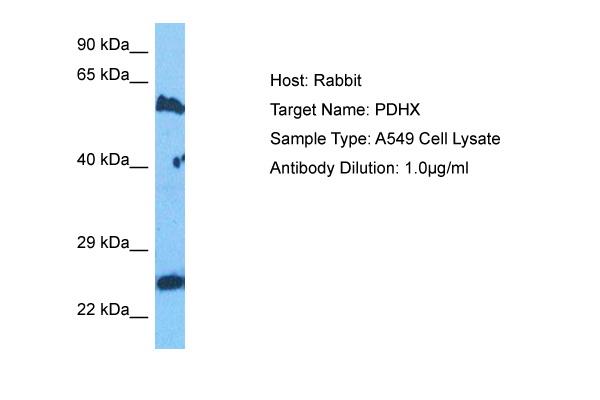 Host: Rabbit<br/>Target Name: PDHX<br/>Sample Tissue: Human A549 Whole cell lysates<br/>Antibody Dilution: 1ug/ml
