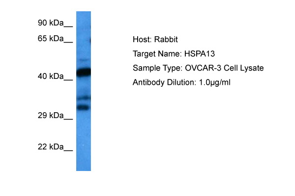 Host: Rabbit<br/>Target Name: HSPA13<br/>Sample Tissue: Human OVCAR-3 Whole Cell lysates<br/>Antibody Dilution: 1ug/ml