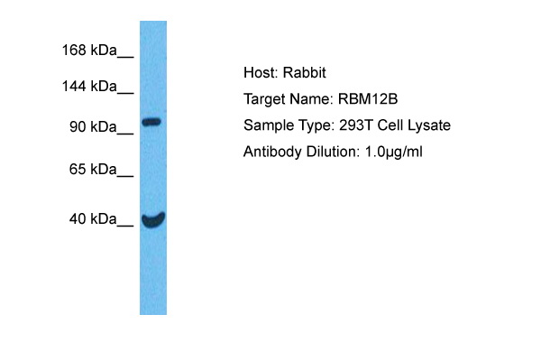 Host: Rabbit<br/>Target Name: RBM12B<br/>Sample Tissue: Human 293T Whole Cell lysates<br/>Antibody Dilution: 1ug/ml