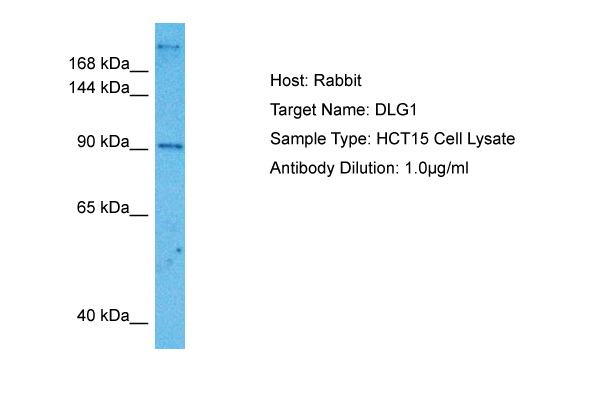 Host: Rabbit<br/>Target Name: DLG1<br/>Sample Tissue: Human HCT15 Whole Cell lysates<br/>Antibody Dilution: 1ug/ml
