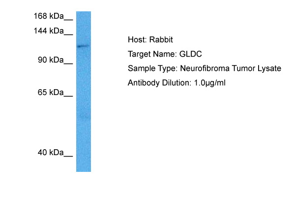 Host: Rabbit<br/>Target Name: GLDC<br/>Sample Tissue: Human Neurofibroma Tumor lysates<br/>Antibody Dilution: 1ug/ml