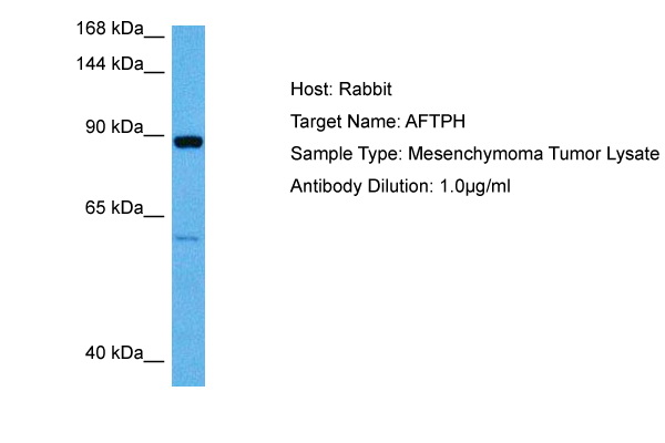 Host: Rabbit<br/>Target Name: AFTPH<br/>Sample Tissue: Human Mesenchymoma Tumor lysates<br/>Antibody Dilution: 1ug/ml